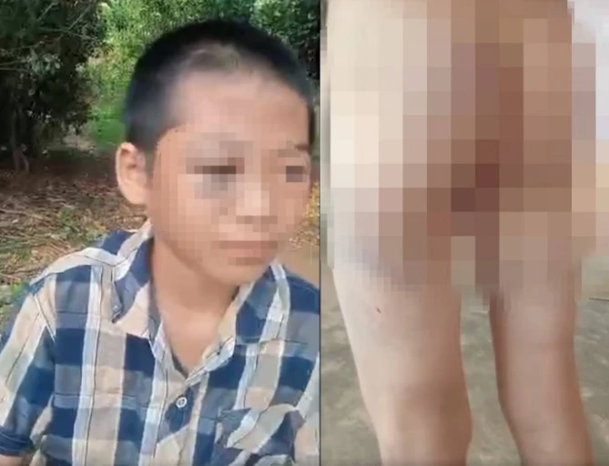 Chi tiết cực đắt trong vụ bé lớp 6 nghi bị mẹ kế và cha bạo hành: Chúng ta cần nhìn lại để dạy con mình!