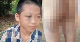 Chi tiết cực đắt trong vụ bé lớp 6 nghi bị mẹ kế và cha bạo hành: Chúng ta cần nhìn lại để dạy con mình!