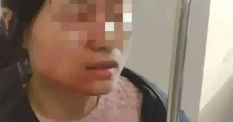 Cô giáo tiểu học bị đâm vỡ nhãn cầu vì can ngăn học sinh đánh nhau: Kẻ thủ ác không bị xử phạt vì chưa đủ 14 tuổi!