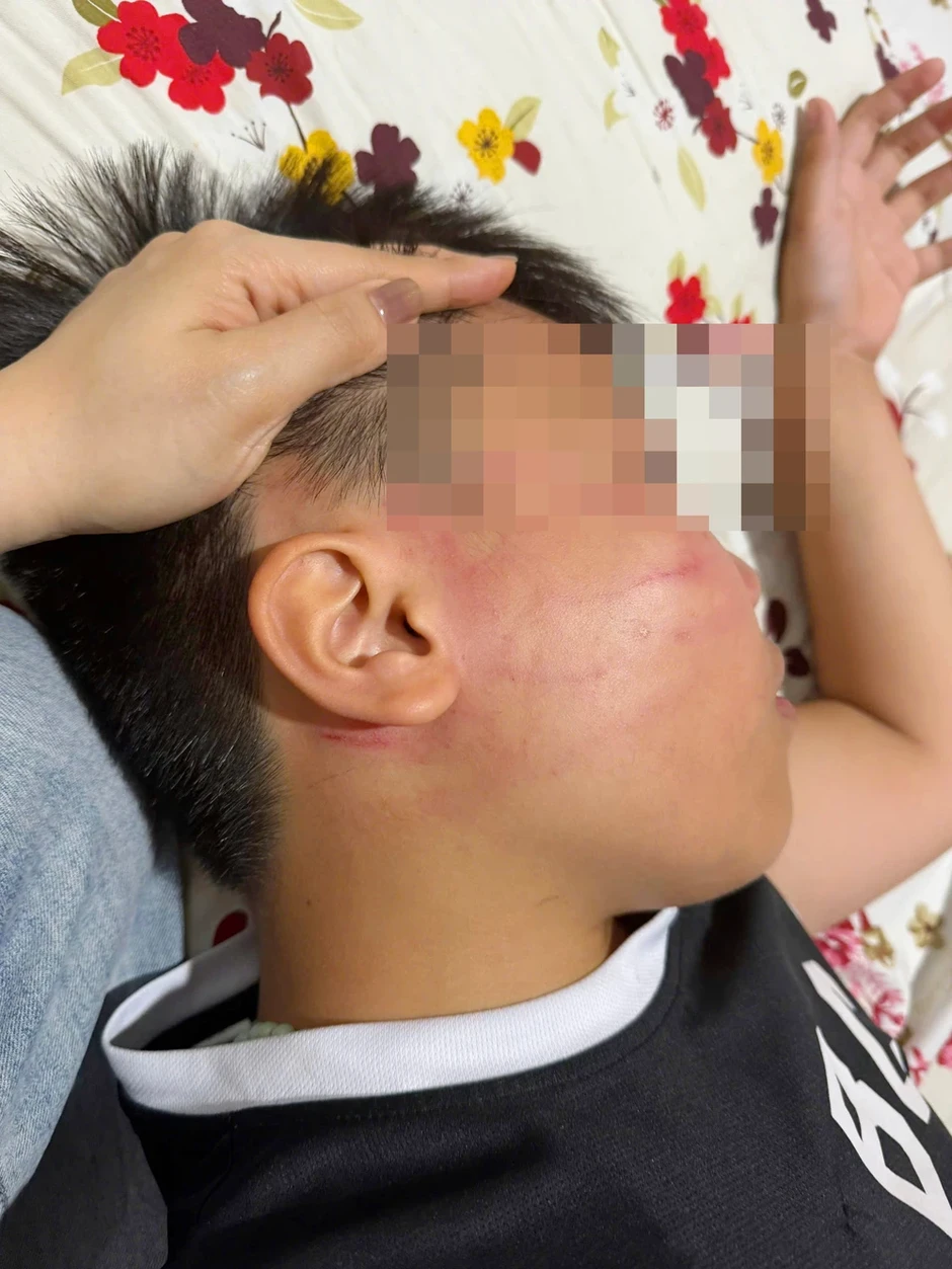 Công an xác minh vụ học sinh lớp 4 bị giáo viên dạy thêm tiếng Anh tát vào mặt Công an xác minh vụ học sinh lớp 4 bị giáo viên dạy thêm tiếng Anh tát vào mặt