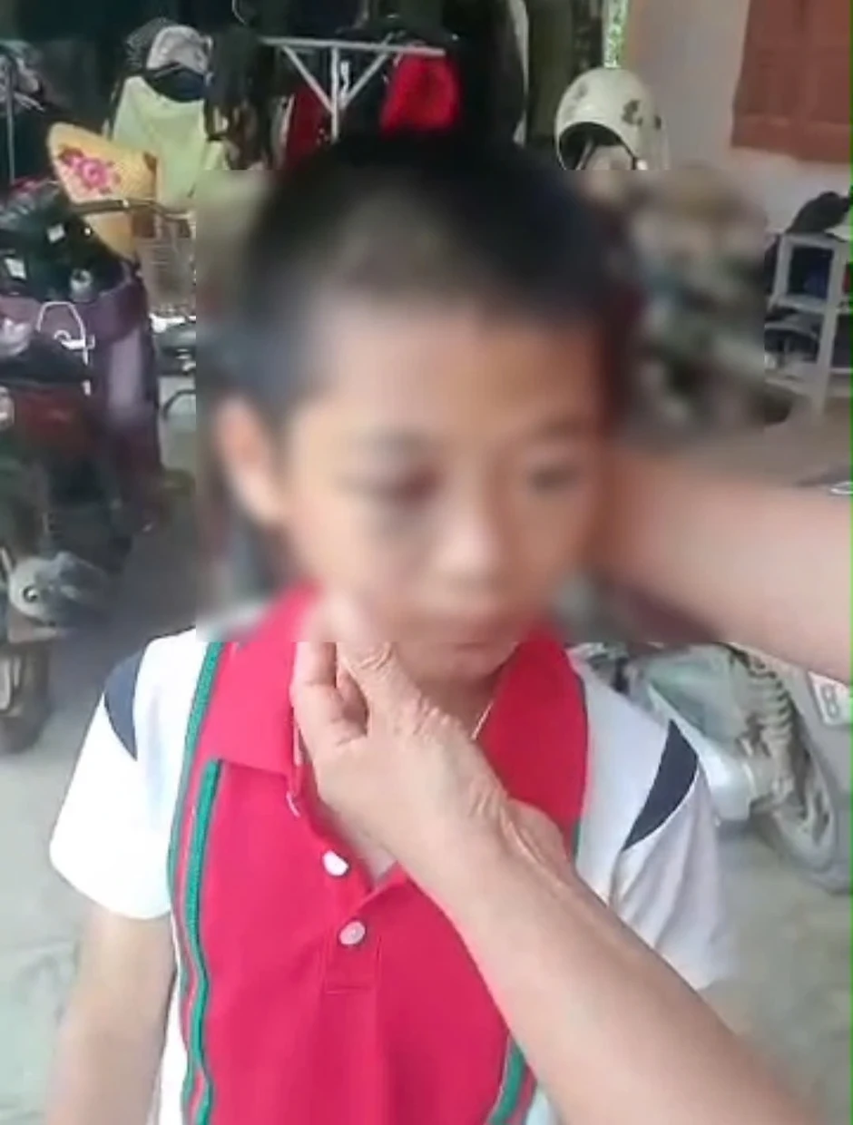 Làm rõ thông tin học sinh lớp 6 nghi bị mẹ kế bạo hành Làm rõ thông tin học sinh lớp 6 nghi bị mẹ kế bạo hành