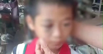 Làm rõ thông tin học sinh lớp 6 nghi bị mẹ kế bạo hành