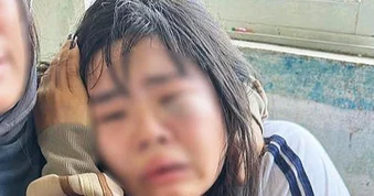 Nữ sinh bị đánh tới tấp trước cổng trường có dấu hiệu hoảng loạn, nôn ói