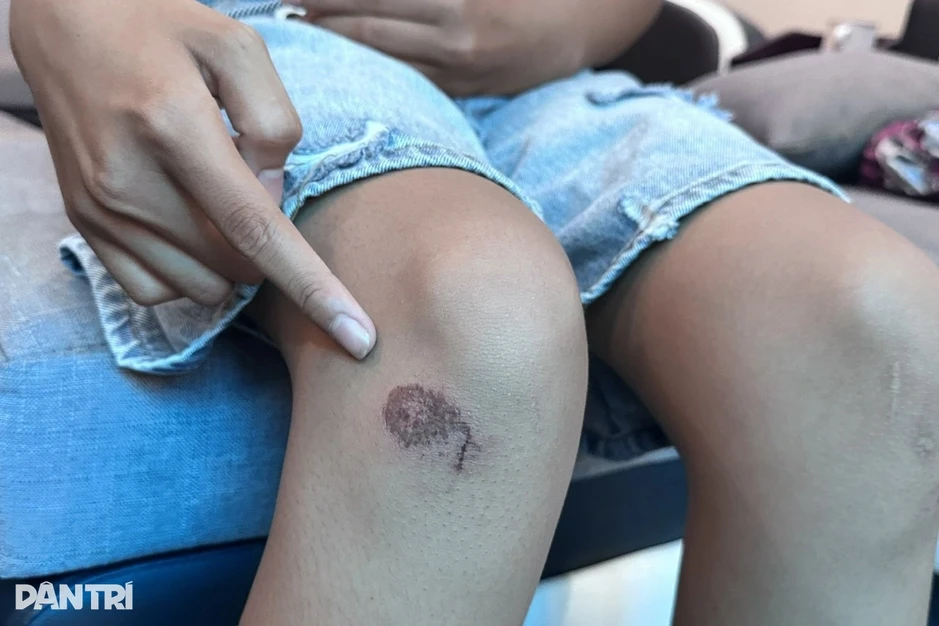Nữ sinh lớp 6 bị đánh, bắt quỳ gối lau chân cho bạn, gia đình báo công an
