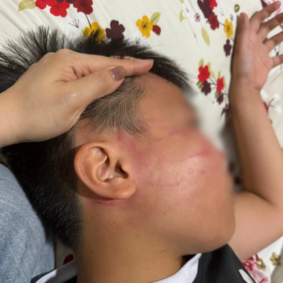 Thông tin mới vụ nam sinh 9 tuổi nghi bị giáo viên dạy thêm đánh Thông tin mới vụ nam sinh 9 tuổi nghi bị giáo viên dạy thêm đánh