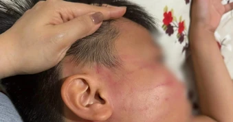 Thông tin mới vụ nam sinh 9 tuổi nghi bị giáo viên dạy thêm đánh