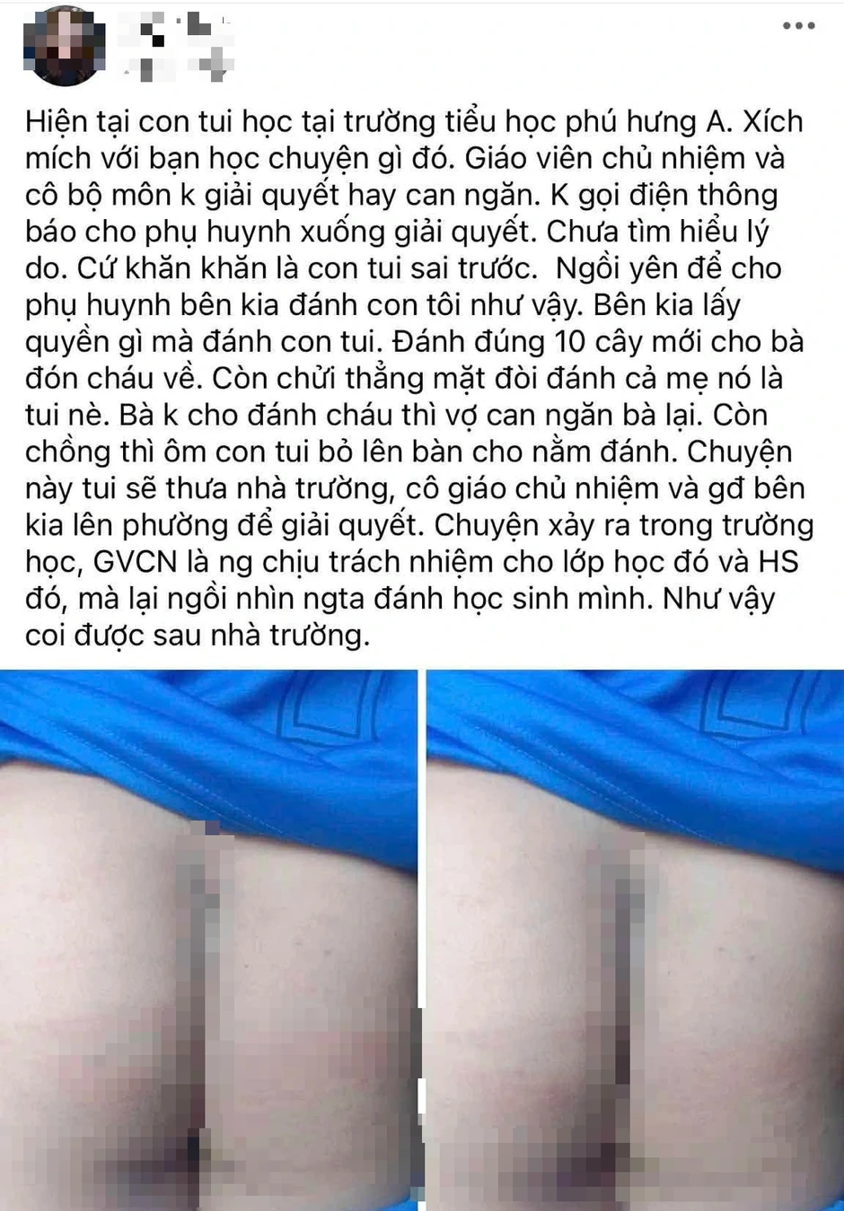 Vụ phụ huynh vào trường đánh học sinh: Kiểm điểm hiệu trưởng