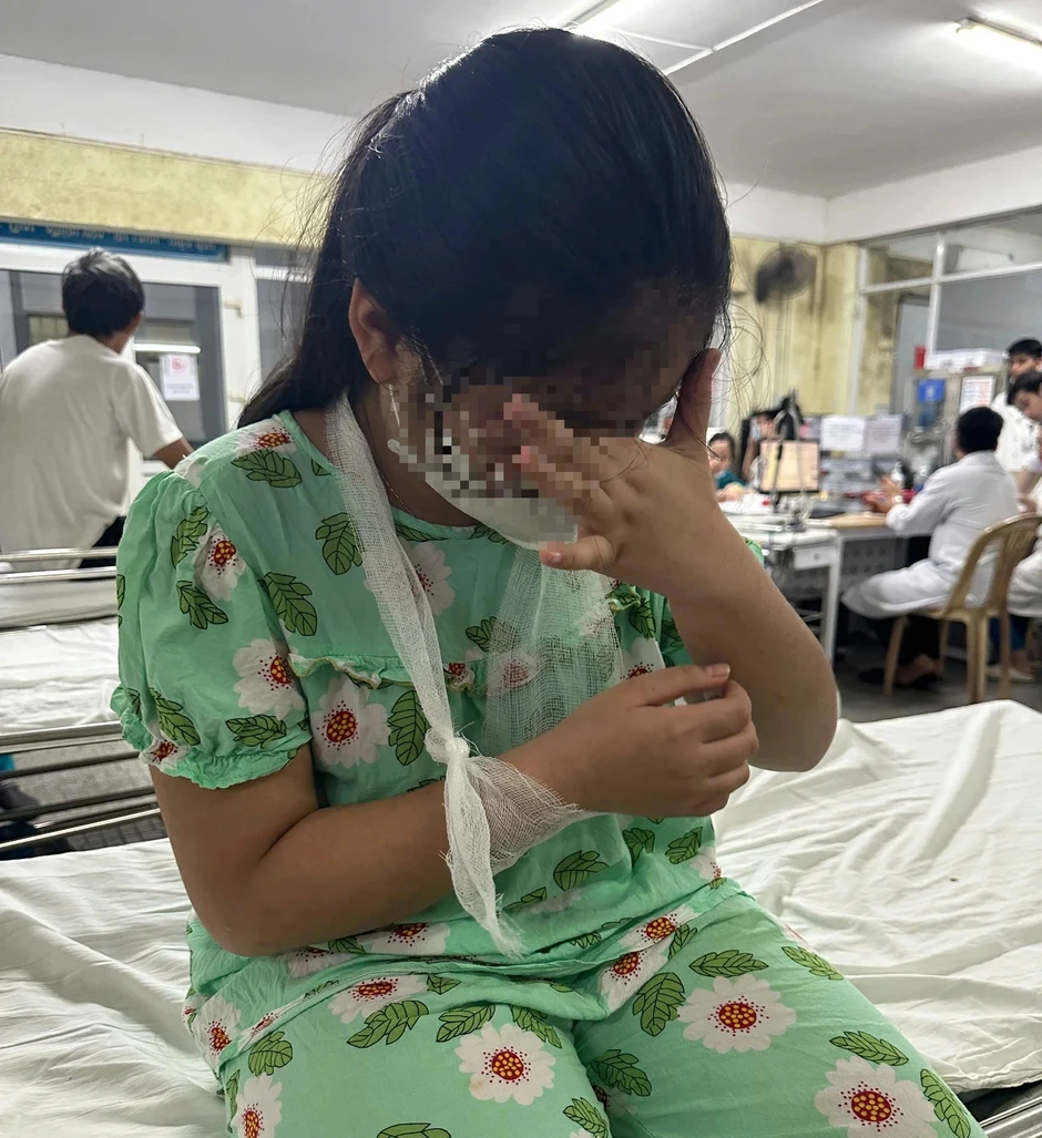 Xác minh vụ giáo viên dùng thước đánh học sinh tiểu học 'chấn thương' ở tay Xác minh vụ giáo viên dùng thước đánh học sinh tiểu học 'chấn thương' ở tay