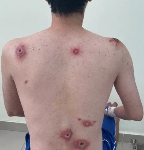 Thay đổi đáng báo động về bệnh lây qua tình dục tại TP.HCM Thay đổi đáng báo động về bệnh lây qua tình dục tại TP.HCM