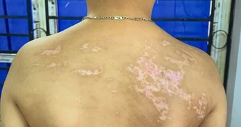 Khởi tố ông bố bạo hành con ruột gây thương tích 36%