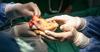 Đột phá “tuổi thọ” nội tạng của Trung Quốc mở ra hy vọng mới cho ghép tạng