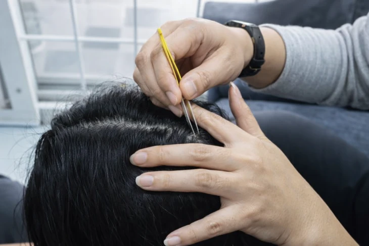 Nhổ tóc bạc cho 'đỡ ngứa mắt', coi chừng tóc không mọc lại Nhổ tóc bạc cho 'đỡ ngứa mắt', coi chừng tóc không mọc lại