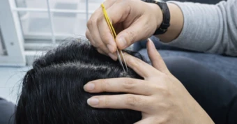 Nhổ tóc bạc cho 'đỡ ngứa mắt', coi chừng tóc không mọc lại