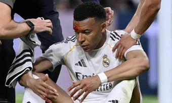 Mbappe khâu 3 mũi sau va chạm ở La Liga