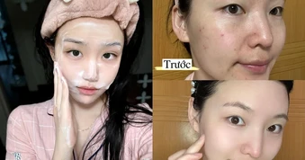 +6 sữa rửa mặt giúp giảm mụn 'cứu nguy' da láng mịn, cải thiện lỗ chân lông