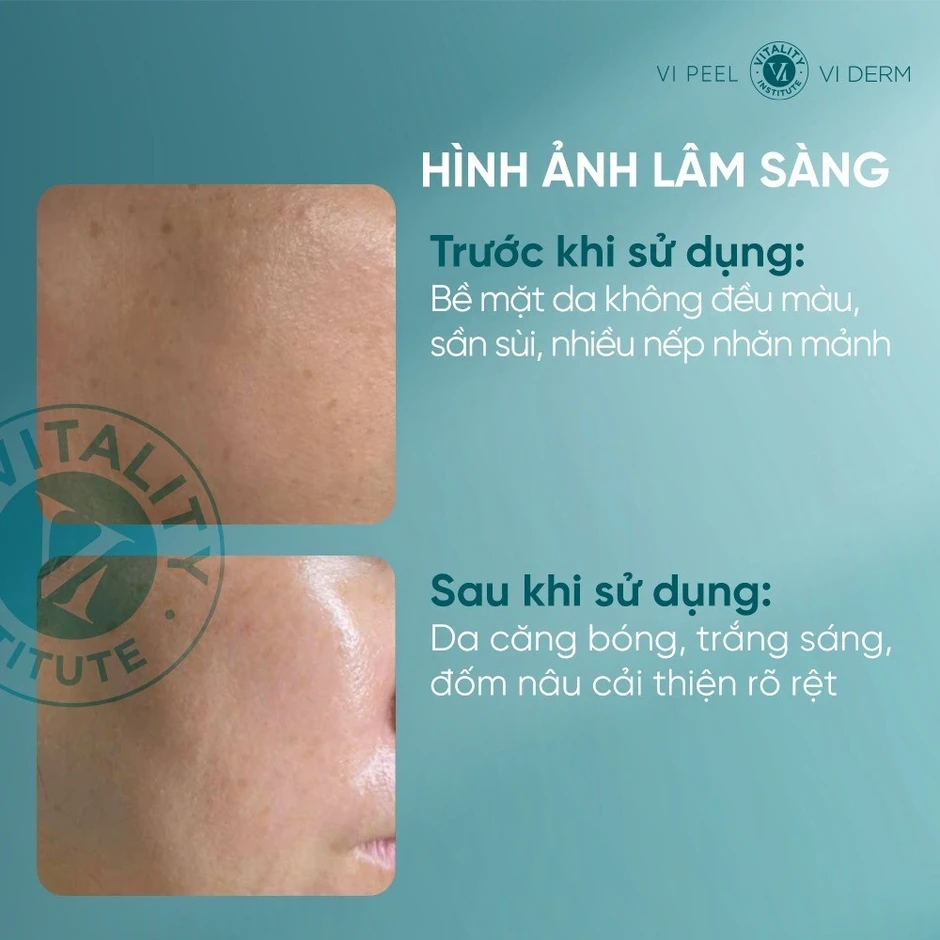 3 kem trắng da chống lão hóa U30+ khiến chị em mua vội kẻo lại ‘cháy hàng’ 3 kem trắng da chống lão hóa U30+ khiến chị em mua vội kẻo lại ‘cháy hàng’