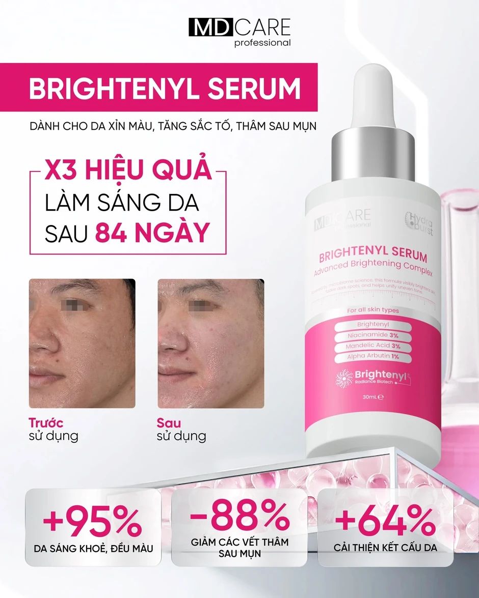 5 kem giúp mờ nám, da trắng sáng sau khoảng 4 tuần, kể cả nám hỗn hợp 5 kem giúp mờ nám, da trắng sáng sau khoảng 4 tuần, kể cả nám hỗn hợp