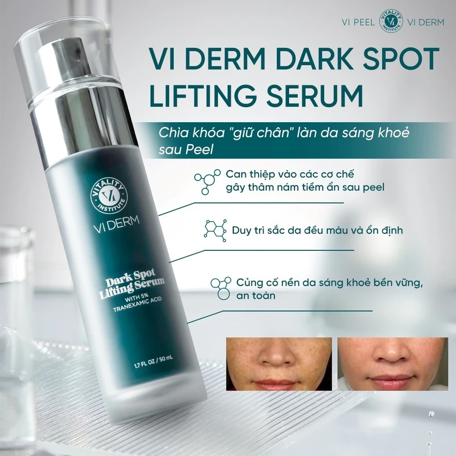 5 kem giúp mờ nám, da trắng sáng sau khoảng 4 tuần, kể cả nám hỗn hợp 5 kem giúp mờ nám, da trắng sáng sau khoảng 4 tuần, kể cả nám hỗn hợp