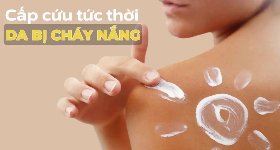 5 mẹo chống nắng ‘sống còn’ khi đi du lịch: Da trắng hồng bất chấp nắng gắt 5 mẹo chống nắng ‘sống còn’ khi đi du lịch: Da trắng hồng bất chấp nắng gắt