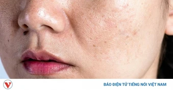 5 sai lầm mỗi ngày khiến da dễ nám hơn, nhiều chị em vẫn vô tình mắc