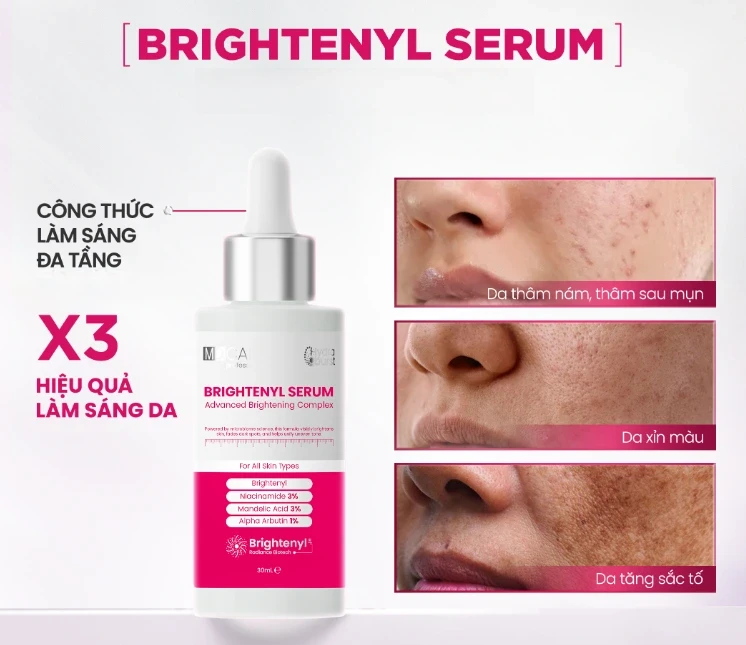 5 serum mờ nám lâu năm không cần laser: Làm mờ đốm nâu, làn da trắng sáng 5 serum mờ nám lâu năm không cần laser: Làm mờ đốm nâu, làn da trắng sáng
