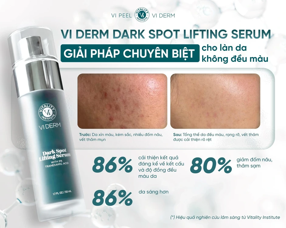 5 serum mờ nám lâu năm không cần laser: Làm mờ đốm nâu, làn da trắng sáng 5 serum mờ nám lâu năm không cần laser: Làm mờ đốm nâu, làn da trắng sáng