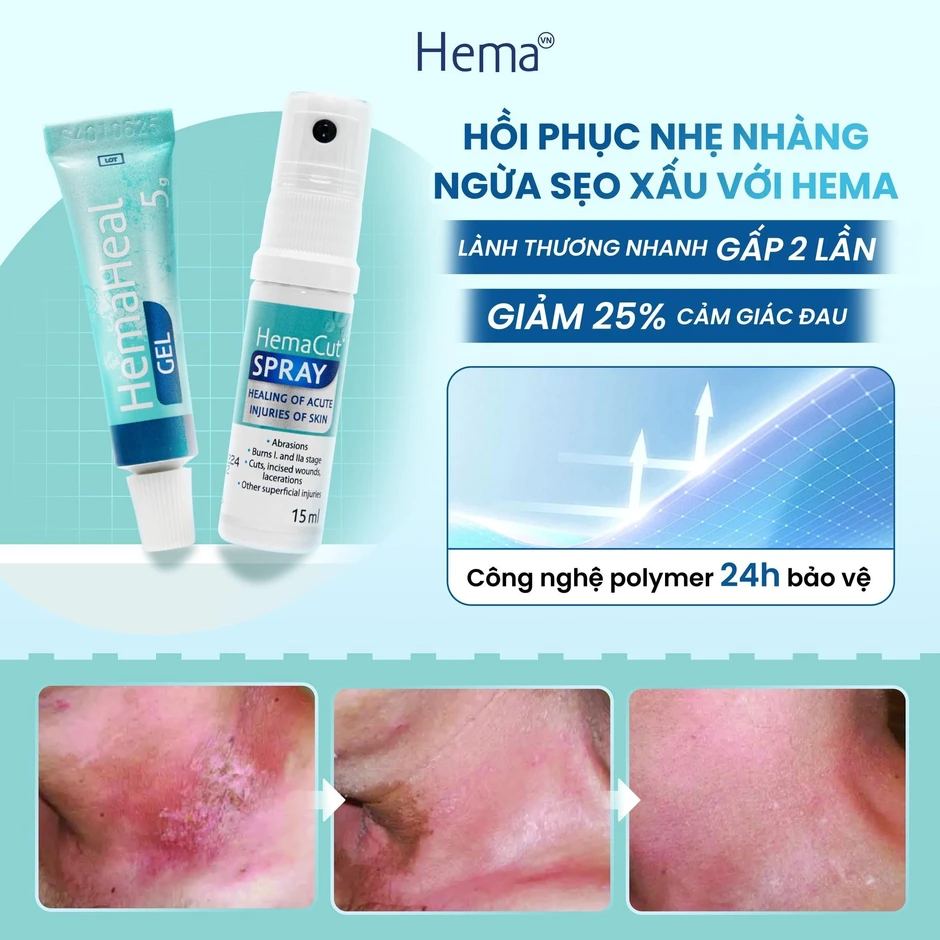 Bật mí cách xử lý vết thương chuẩn y khoa mà nhiều người thực hiện sai