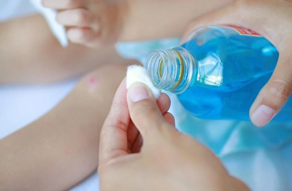 Bật mí cách xử lý vết thương chuẩn y khoa mà nhiều người thực hiện sai