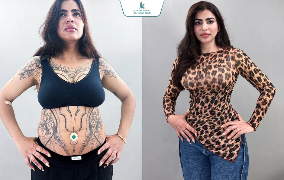 BS Lê Phước Tiền và xu hướng tạo hình vóc dáng chuẩn quốc tế BS Lê Phước Tiền và xu hướng tạo hình vóc dáng chuẩn quốc tế