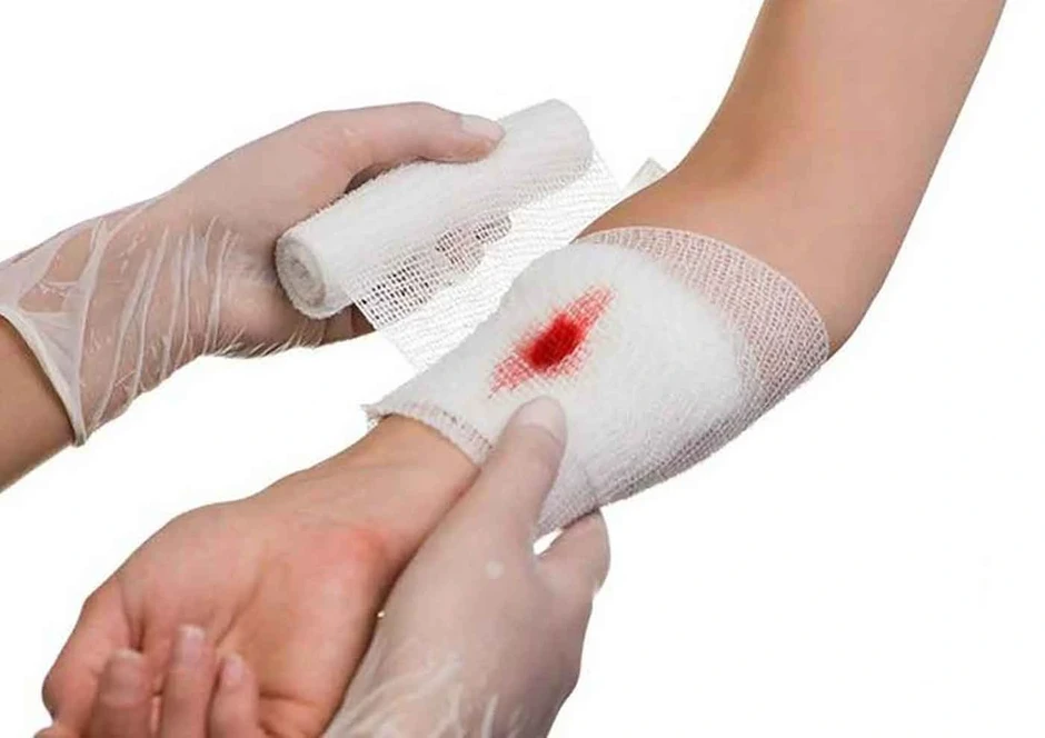 Cách giúp vết thương hở nhanh lành chuẩn y khoa ngăn ngừa nhiễm trùng và sẹo xấu Cách giúp vết thương hở nhanh lành chuẩn y khoa ngăn ngừa nhiễm trùng và sẹo xấu