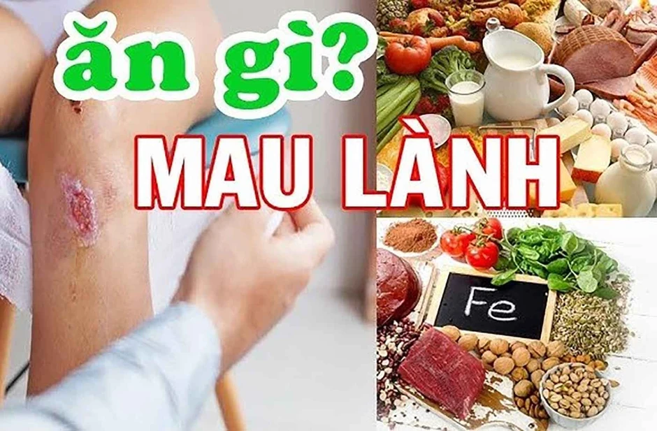 Cách giúp vết thương hở nhanh lành chuẩn y khoa ngăn ngừa nhiễm trùng và sẹo xấu Cách giúp vết thương hở nhanh lành chuẩn y khoa ngăn ngừa nhiễm trùng và sẹo xấu