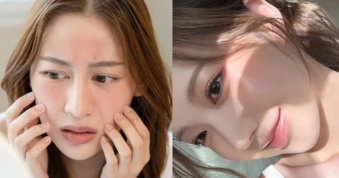 Collagen không phải cứ uống là đẹp mà bí quyết từ chuyên gia chia sẻ dưới đây!