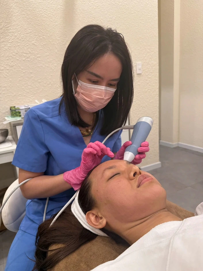 'Cứu' làn da bị sẹo lõm với công nghệ RF Microneedling 'Cứu' làn da bị sẹo lõm với công nghệ RF Microneedling