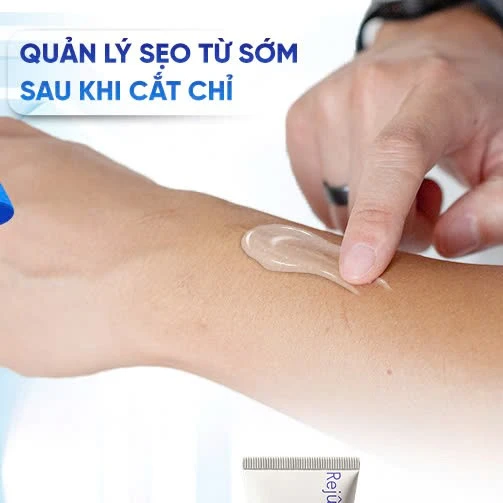 Gel Rejuvasil giúp ngăn ngừa sẹo mới và làm mờ sẹo lồi phẫu thuật có tốt không?