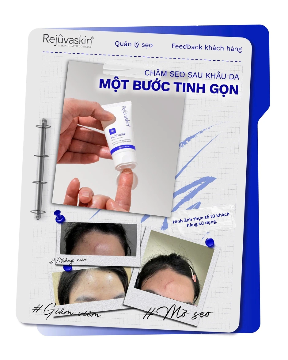 Gel Rejuvasil giúp ngăn ngừa sẹo mới và làm mờ sẹo lồi phẫu thuật có tốt không?