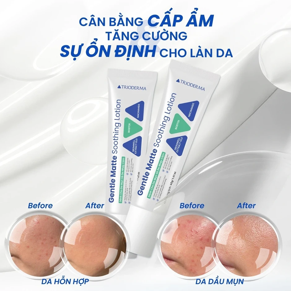 Gentle Matte Soothing Lotion: Khi công nghệ BioDTox trở thành ‘lá chắn’ cho làn da đô thị Gentle Matte Soothing Lotion: Khi công nghệ BioDTox trở thành ‘lá chắn’ cho làn da đô thị