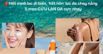 Hết mình lúc đi biển, 'hết hồn' lúc cháy nắng: 5 mẹo cứu làn da cực nhạy