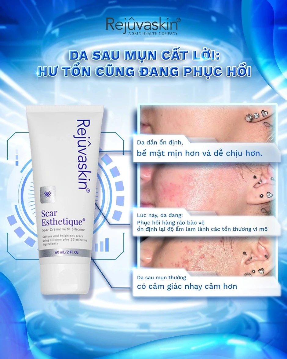 Hướng dẫn sử dụng kem mờ sẹo thâm Scar Esthetique đúng chuẩn để không phí tiền