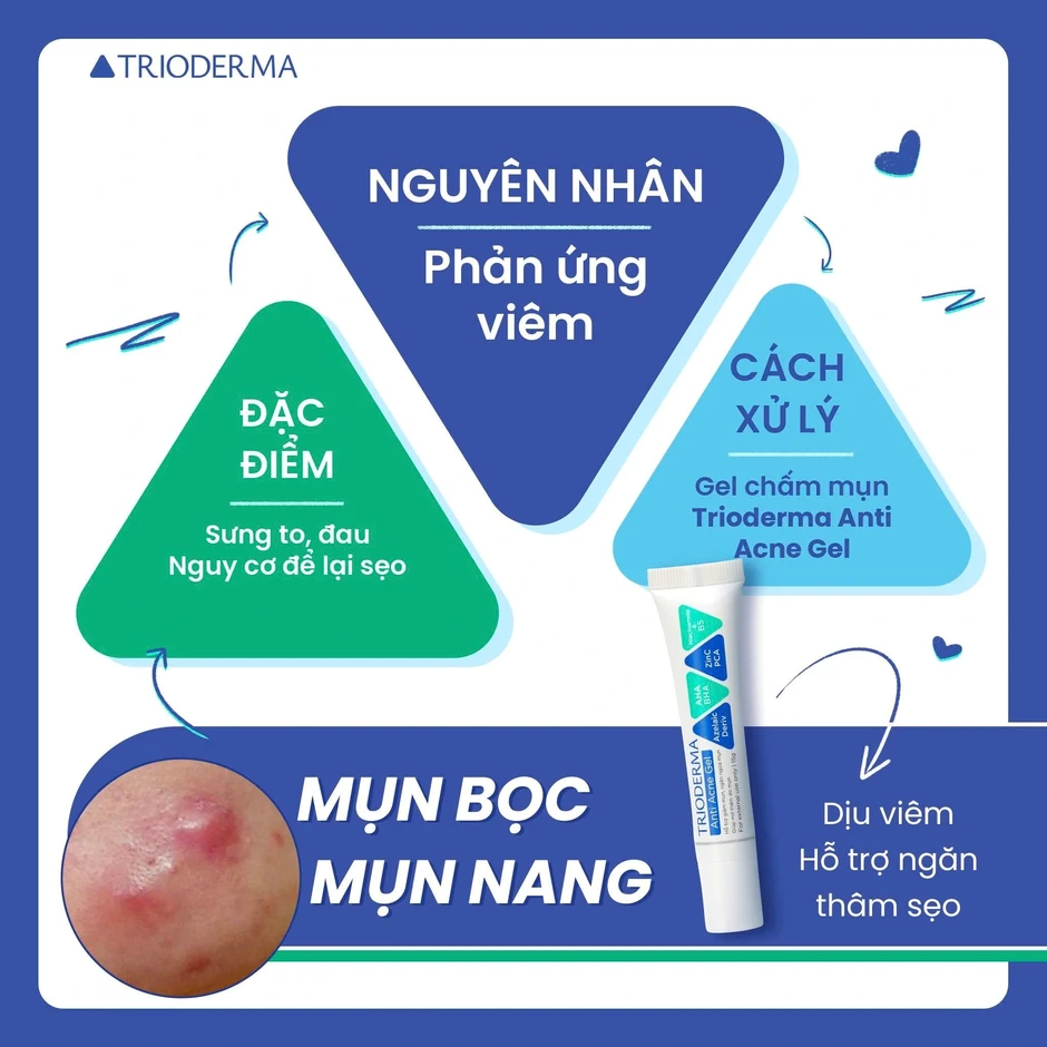 Kem chấm mụn trên trán nào có lượt bán top đầu TikTok hiện nay? Kem chấm mụn trên trán nào có lượt bán top đầu TikTok hiện nay?