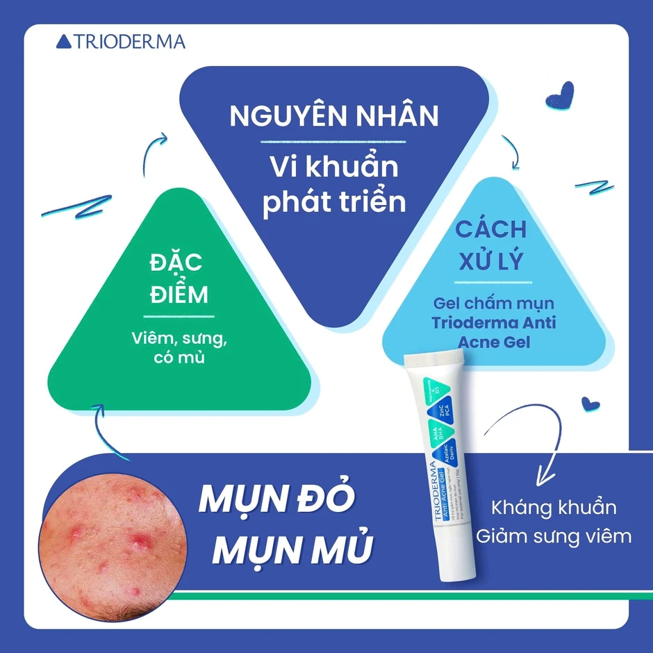 Kem chấm mụn trên trán nào có lượt bán top đầu TikTok hiện nay? Kem chấm mụn trên trán nào có lượt bán top đầu TikTok hiện nay?