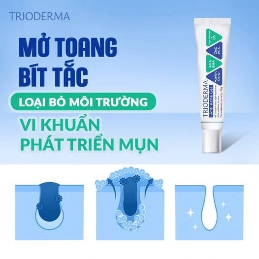 Kem giúp ngừa mụn đầu đen cực đỉnh: Mũi sạch bong, căng bóng như vừa đi spa