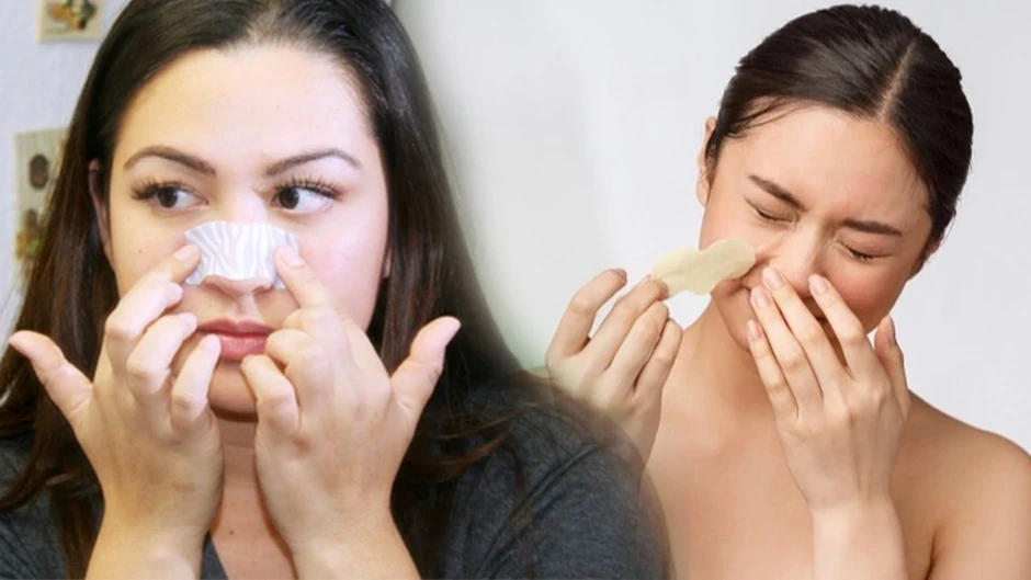 Kem giúp ngừa mụn đầu đen cực đỉnh: Mũi sạch bong, căng bóng như vừa đi spa