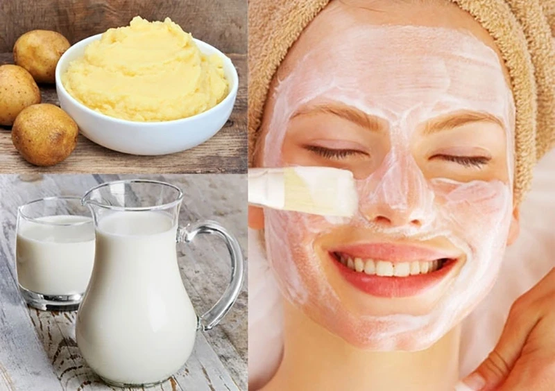 Không cần mỹ phẩm đắt tiền: Bí quyết trị mụn bằng khoai tây ngay tại nhà