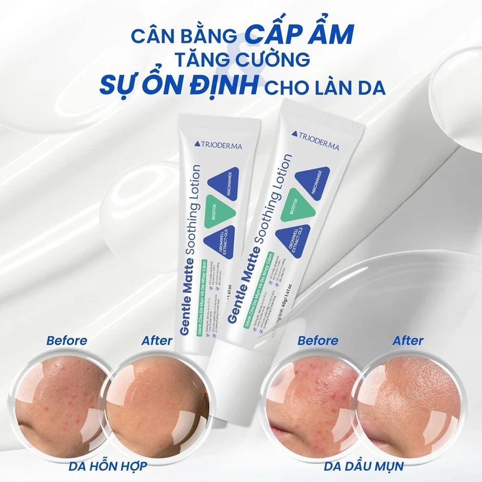 Lotion cho da nhạy cảm: Bôi 1 lần, giúp làm dịu da, giảm đỏ rát thấy rõ Lotion cho da nhạy cảm: Bôi 1 lần, giúp làm dịu da, giảm đỏ rát thấy rõ