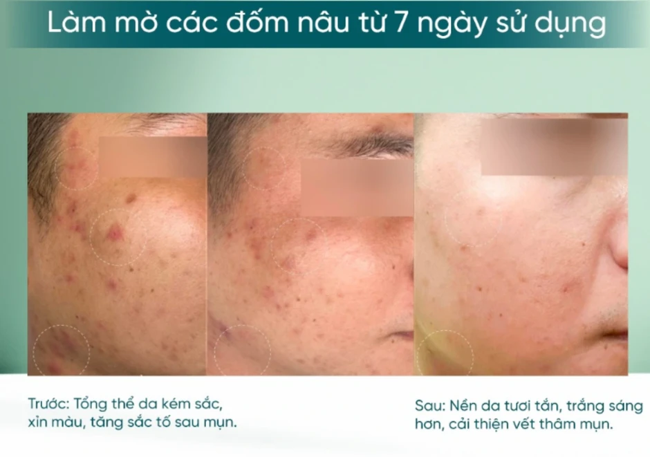 Lưu ngay 5 serum chống lão hóa 'bơm đầy' collagen, da căng bóng chẳng cần tiêm filler Lưu ngay 5 serum chống lão hóa 'bơm đầy' collagen, da căng bóng chẳng cần tiêm filler