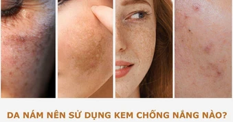 Nám tái đi tái lại do chưa ‘update’ 3 kem chống nắng cho da nám dưới đây!