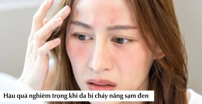 Nắng nóng gần 40 độ: Da bỏng rát, sạm màu? Cách phục hồi sau 1 đêm