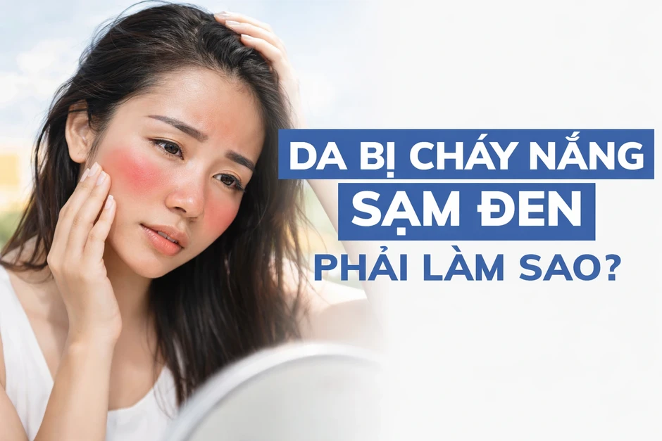 Nắng nóng gần 40 độ: Da bỏng rát, sạm màu? Cách phục hồi sau 1 đêm
