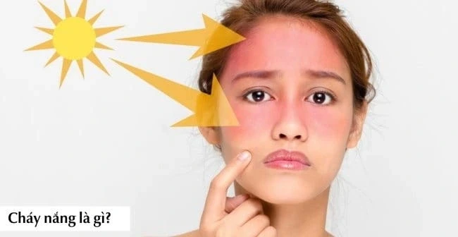 Nắng nóng gần 40 độ: Da bỏng rát, sạm màu? Cách phục hồi sau 1 đêm