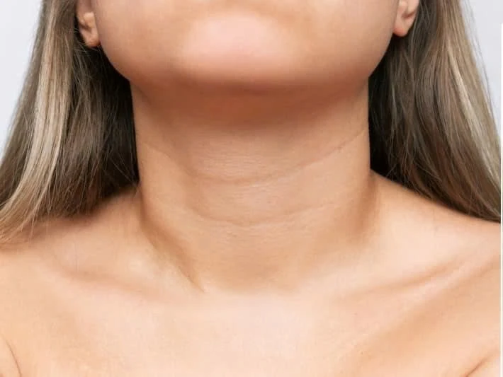 Nếp nhăn ở cổ ngày càng sâu: Làm sao cải thiện hiệu quả?